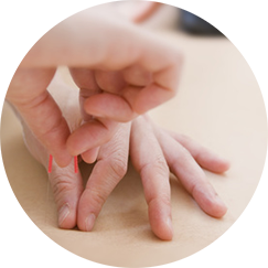 鍼灸施術の様子